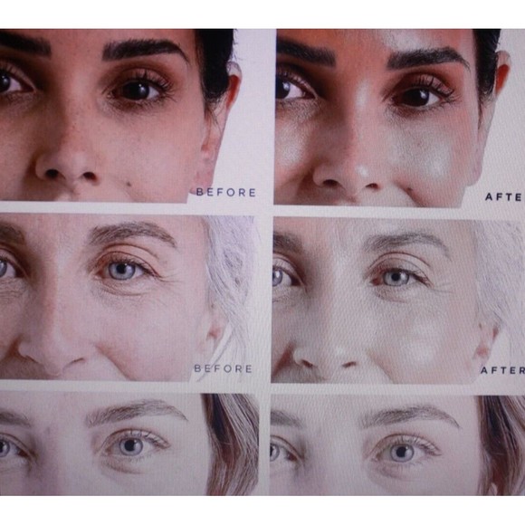 Retinol Serum for Skin Care Oil Drops Improve Elasticity .68 Fl.Oz. NIP - Picture 3 of 8